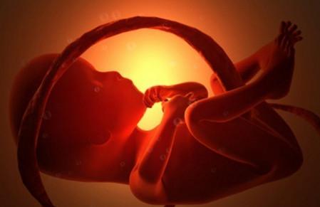 胎儿脐带绕颈，如何化险为夷？