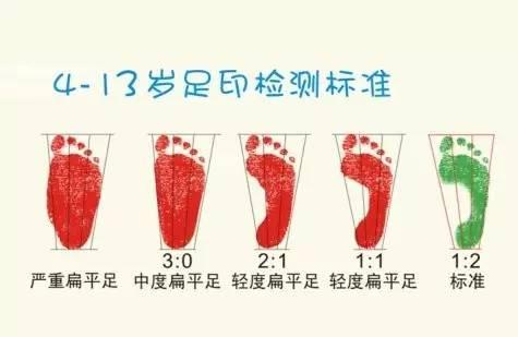孩子走路总喊脚疼，当心扁平足作怪！