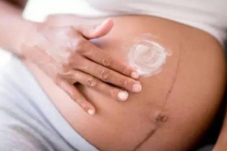 到底是男宝宝还是女宝宝？看妊娠线真的看得出来？