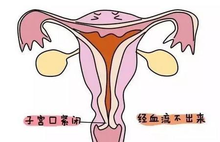 结婚、生孩子就不再痛经了？破解痛经的江湖传闻！