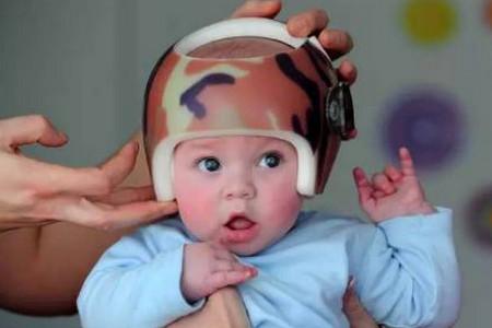头型不好（扁头、斜头）会不会影响宝宝智力发育？