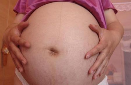 橄榄油可防妊娠纹？