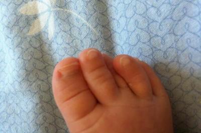 儿童脚甲沟炎怎么治疗