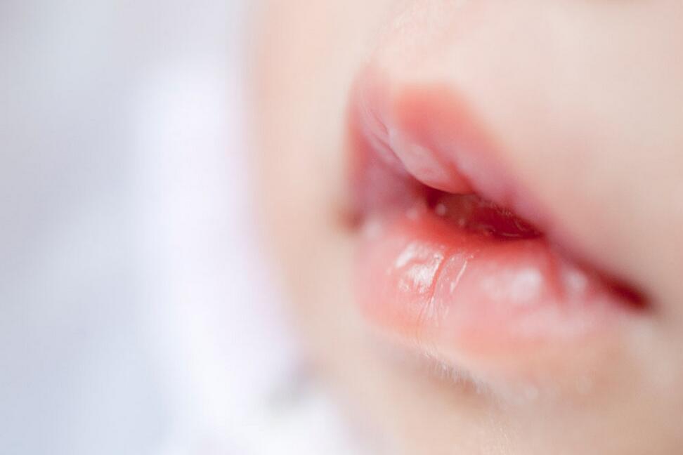 宝宝嘴巴脱皮怎么办