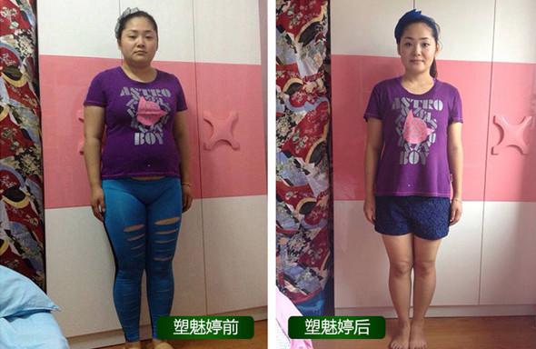产后怎样快速瘦肚子?快速瘦肚子的方法首选塑魅婷