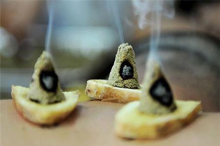 宫颈炎艾灸有用吗