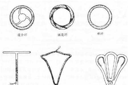避孕环怎么放进去图解