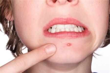 怎样调节内分泌失调