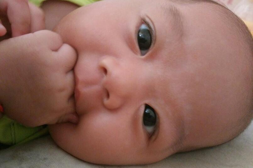 宝宝眉毛有白斑是怎么回事