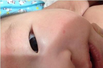 孩子嘴巴里面起小红点怎么回事