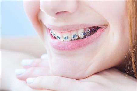 带牙套的最佳年龄