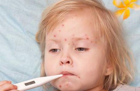 就算打过水痘疫苗依然会被传染？进入水痘高发期各位宝妈务必这样做！