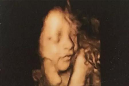 怀孕6月四维彩超图