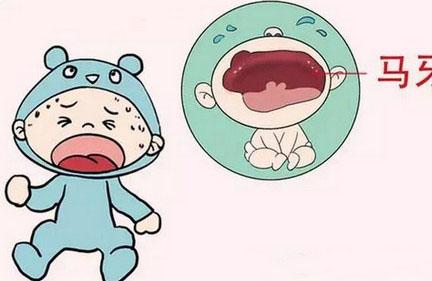 科学认知宝宝马牙！别因无知而后悔！