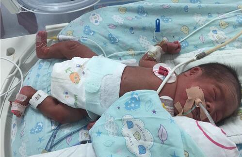 新生儿用呼吸机的原因