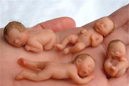 溶血性黄疸怎么治疗