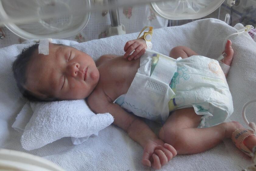 早产儿智力低下的表现