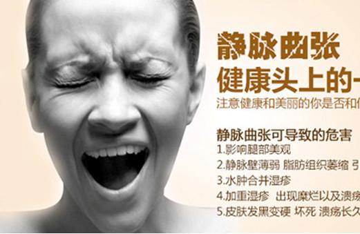 小腿静脉曲张对孕妇有什么影响,舒静通我的安全选择