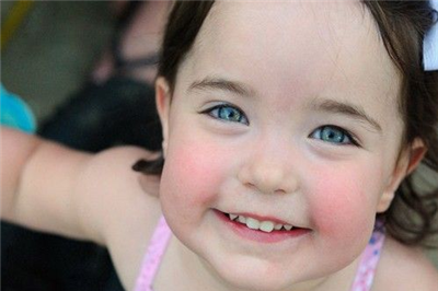 儿童黑眼圈怎么回事