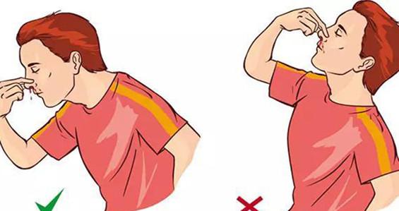 流鼻血的时候怎么办