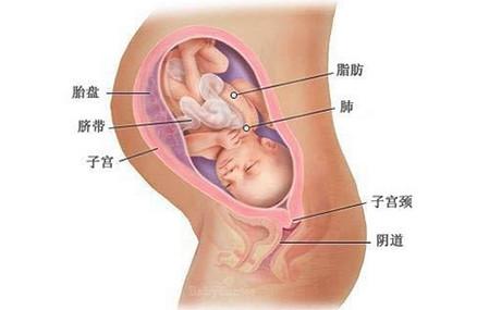 胎儿臀位，一定要剖宫产吗？