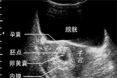 孕囊和卵黄囊的区别