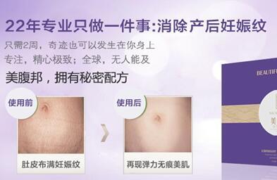 去妊辰纹用什么好？美腹邦成为辣妈们信赖的好产品