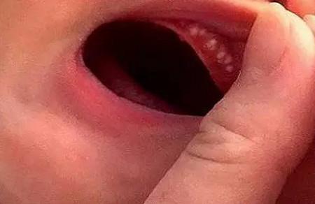 宝宝口腔内的门门道道，当妈的不知道还真不行！
