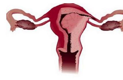想受孕！该拿你怎么办，薄薄的子宫内膜？