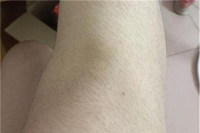 体毛多的女生吃什么好