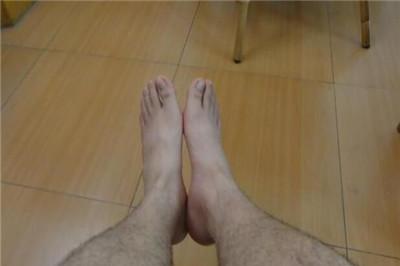 女人体毛旺盛代表什么