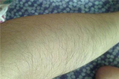 怎样用牙膏去腿毛