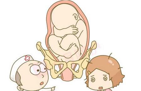 阴道分娩的四大条件，看看你符合否？
