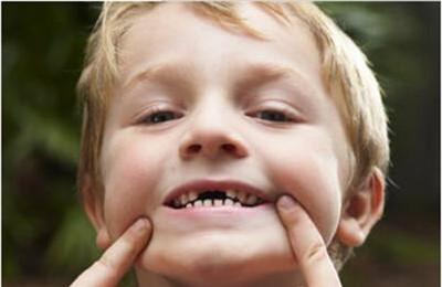 儿童龋齿的原因有哪些