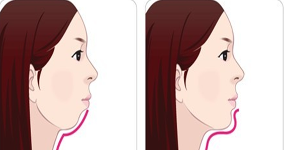 乳牙对颌面部骨骼发育的影响