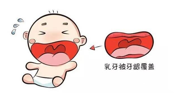 慢性鼻炎对牙齿发育的影响