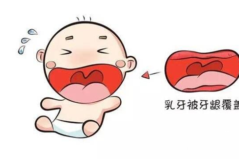 慢性鼻炎对牙齿发育的影响