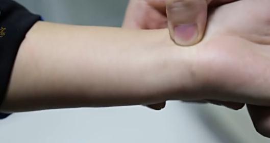 小儿推拿穴位作用之总筋的作用