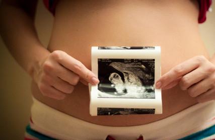 孕育新生命本是件开心的事情，但宝宝却没有胎心。对于胎停育，你了解多少？