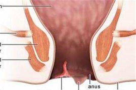 产后肛裂怎么诊疗