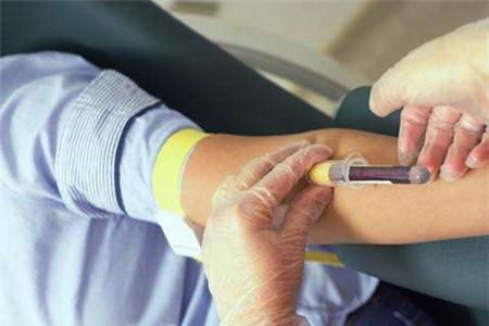 检测艾滋病需要空腹抽血吗