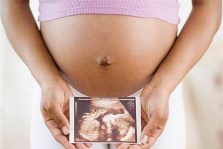 经产妇入盆晚的原因