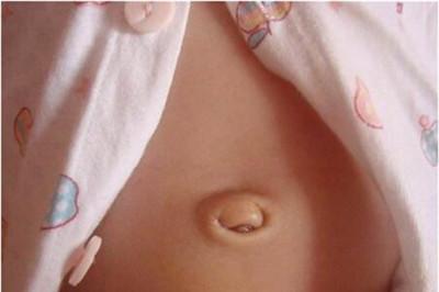 宝宝肚脐眼凸起怎么办