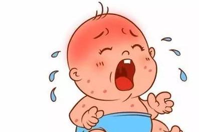 天气不热宝宝也出汗多，是正常还是疾病?