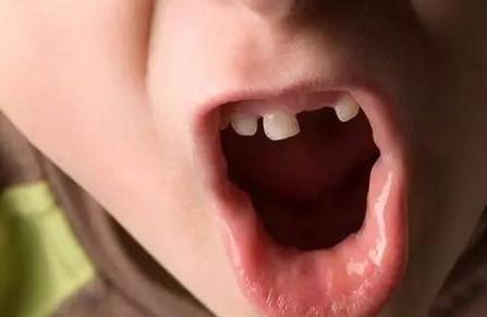 孩子乳牙掉了别再傻傻丢了，储存下来可救命！