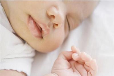 宝宝口角炎用什么药膏好