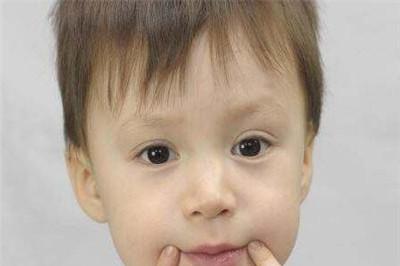 儿童嘴角烂是什么原因