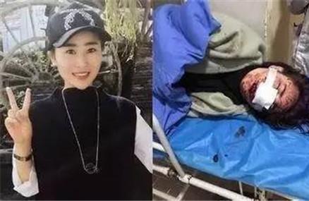 丽江被打毁容女孩近照和遗书首次公开