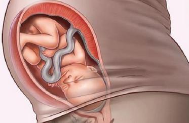 胎宝宝入盆就是要生了？怎样判断胎儿是否入盆了？