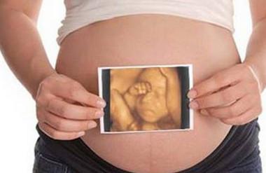 “四维彩超”孕妈有必要做吗？